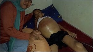 4 Bulan Terbaring Dikasur, Akibat Perut Membesar